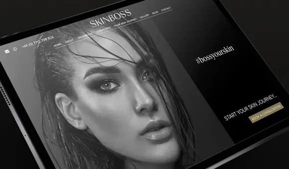 Blow Media - Skinboss